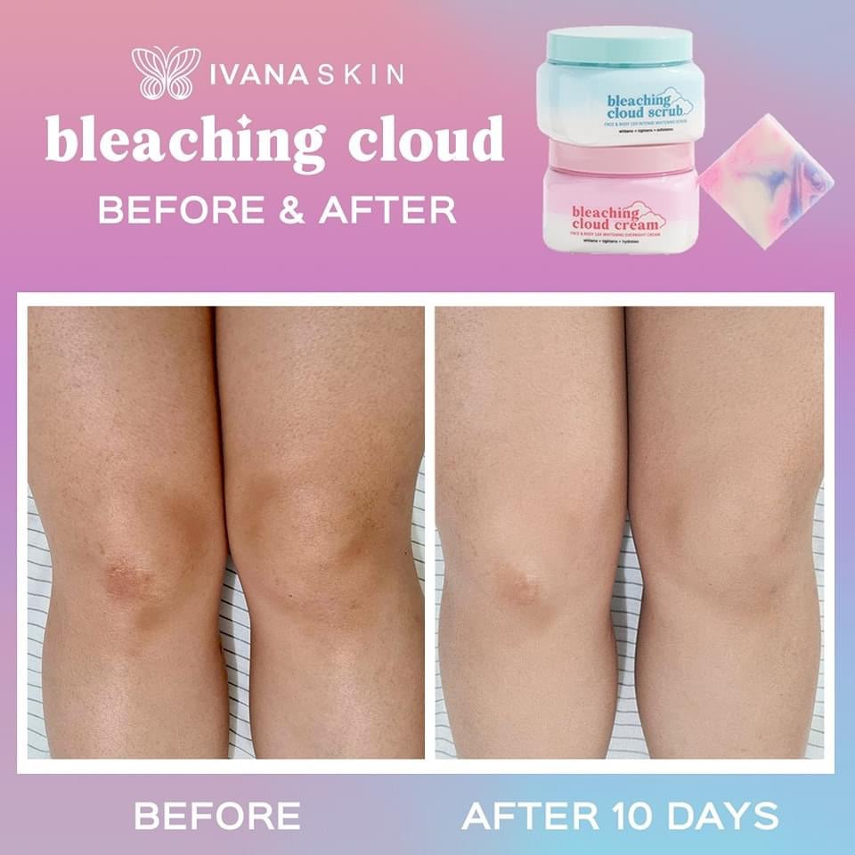 Ivana Bleaching Cloud Cream
